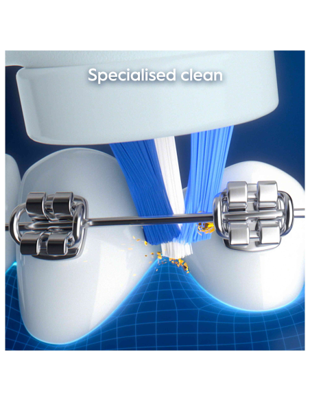 iO My Way Ocean Blue Elektrinis Dantų Šepetėlis + Speciality Brush Head