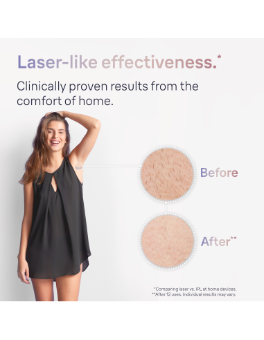 PL7257 Skin i·expert Pro7 IPL Fotoepilaator