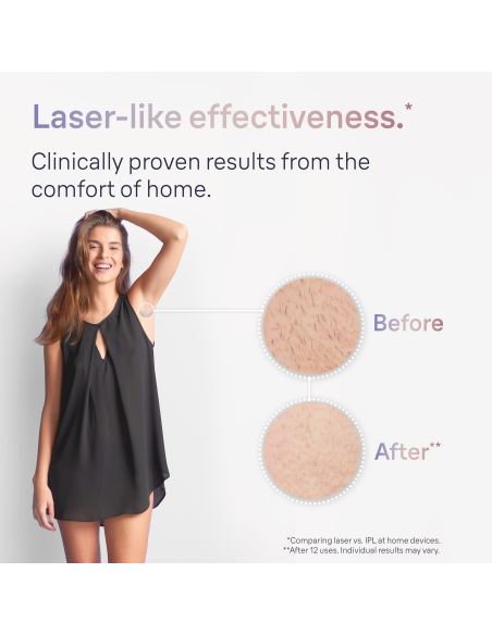 PL7257 Skin i·expert Pro7 IPL Fotoepilaator